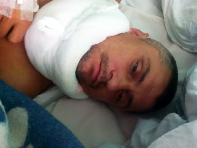 Батьку двох малолітніх дітей з Прикарпаття потрібна допомога (ВІДЕО)