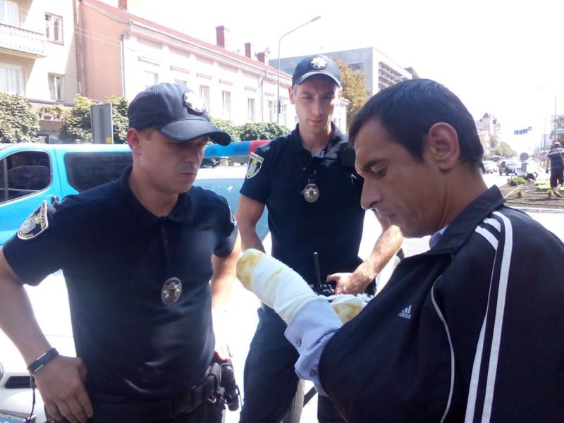 Поліція “зцілила каліку” на початку Стометрівки (ВІДЕО)