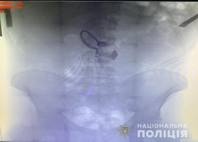 У Києві грабіжник проковтнув крадений ланцюжок (ФОТОФАКТ)