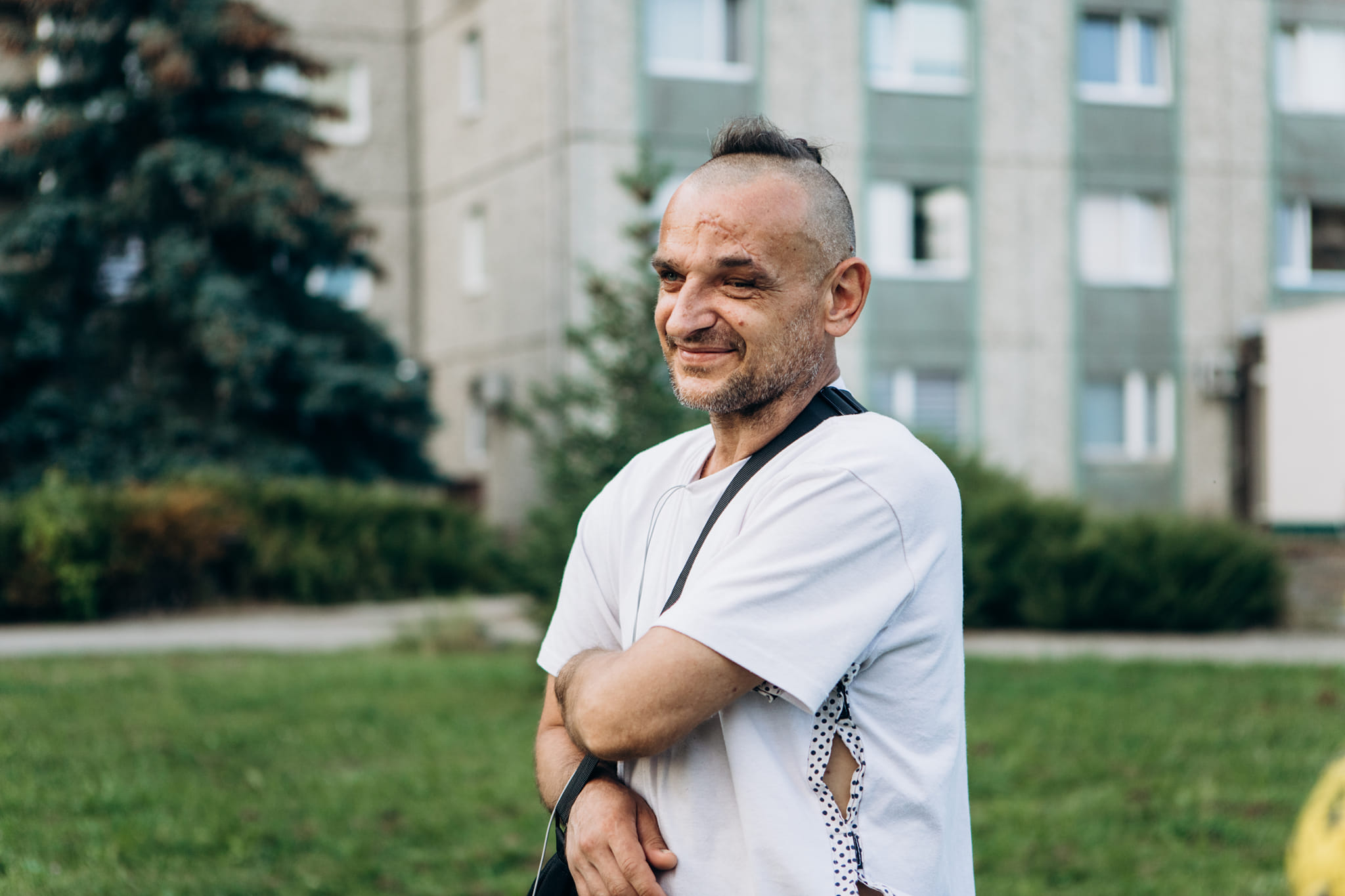 Бійця з Харкова, який втратив око, лікують у Франківську (ФОТОФАКТ)