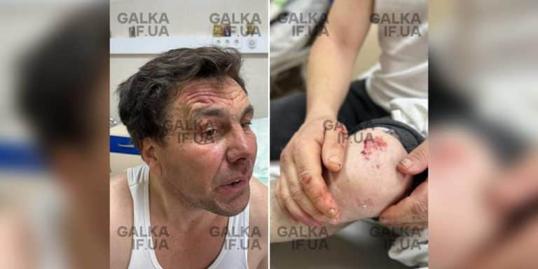 На Прикарпатті чоловік опинився у лікарні після зустрічі з працівниками ТЦК: що відомо (ФОТО)